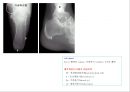 방사선사 국가고시 일반촬영 정리 (일반 영상검사, 일반 촬영, Lower extremity, Hip & pelvis, Spine, Mamo 촬영, 일반촬영 모의고사).ppt 53페이지