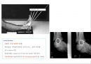 방사선사 국가고시 일반촬영 정리 (일반 영상검사, 일반 촬영, Lower extremity, Hip & pelvis, Spine, Mamo 촬영, 일반촬영 모의고사).ppt 54페이지