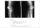 방사선사 국가고시 일반촬영 정리 (일반 영상검사, 일반 촬영, Lower extremity, Hip & pelvis, Spine, Mamo 촬영, 일반촬영 모의고사).ppt 60페이지