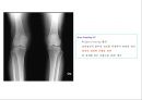 방사선사 국가고시 일반촬영 정리 (일반 영상검사, 일반 촬영, Lower extremity, Hip & pelvis, Spine, Mamo 촬영, 일반촬영 모의고사).ppt 61페이지