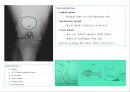 방사선사 국가고시 일반촬영 정리 (일반 영상검사, 일반 촬영, Lower extremity, Hip & pelvis, Spine, Mamo 촬영, 일반촬영 모의고사).ppt 62페이지