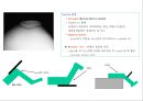 방사선사 국가고시 일반촬영 정리 (일반 영상검사, 일반 촬영, Lower extremity, Hip & pelvis, Spine, Mamo 촬영, 일반촬영 모의고사).ppt 65페이지