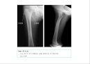 방사선사 국가고시 일반촬영 정리 (일반 영상검사, 일반 촬영, Lower extremity, Hip & pelvis, Spine, Mamo 촬영, 일반촬영 모의고사).ppt 66페이지