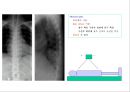 방사선사 국가고시 일반촬영 정리 (일반 영상검사, 일반 촬영, Lower extremity, Hip & pelvis, Spine, Mamo 촬영, 일반촬영 모의고사).ppt 83페이지