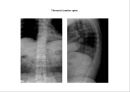 방사선사 국가고시 일반촬영 정리 (일반 영상검사, 일반 촬영, Lower extremity, Hip & pelvis, Spine, Mamo 촬영, 일반촬영 모의고사).ppt 84페이지