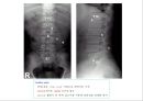 방사선사 국가고시 일반촬영 정리 (일반 영상검사, 일반 촬영, Lower extremity, Hip & pelvis, Spine, Mamo 촬영, 일반촬영 모의고사).ppt 85페이지
