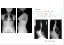 방사선사 국가고시 일반촬영 정리 (일반 영상검사, 일반 촬영, Lower extremity, Hip & pelvis, Spine, Mamo 촬영, 일반촬영 모의고사).ppt 90페이지
