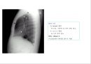 방사선사 국가고시 일반촬영 정리 (일반 영상검사, 일반 촬영, Lower extremity, Hip & pelvis, Spine, Mamo 촬영, 일반촬영 모의고사).ppt 93페이지