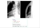방사선사 국가고시 일반촬영 정리 (일반 영상검사, 일반 촬영, Lower extremity, Hip & pelvis, Spine, Mamo 촬영, 일반촬영 모의고사).ppt 97페이지
