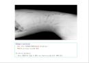 방사선사 국가고시 일반촬영 정리 (일반 영상검사, 일반 촬영, Lower extremity, Hip & pelvis, Spine, Mamo 촬영, 일반촬영 모의고사).ppt 99페이지