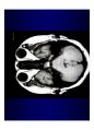 방사선사 MRI 국가고시 2차 정리집 90페이지