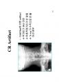 방사선사 영상정보학  국가고시 2차 정리집입니다 - CR, DR, PACS 28페이지