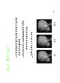방사선사 영상정보학  국가고시 2차 정리집입니다 - CR, DR, PACS 91페이지
