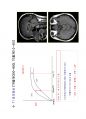 방사선사 MRI 국가고시 2차 정리집 두번째 입니다. - MRI 3페이지