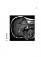 방사선사 MRI 국가고시 2차 정리집 두번째 입니다. - MRI 10페이지