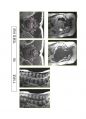 방사선사 MRI 국가고시 2차 정리집 두번째 입니다. - MRI 11페이지