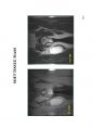 방사선사 MRI 국가고시 2차 정리집 두번째 입니다. - MRI 14페이지