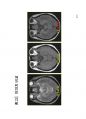 방사선사 MRI 국가고시 2차 정리집 두번째 입니다. - MRI 34페이지
