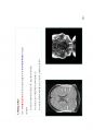 방사선사 MRI 국가고시 2차 정리집 두번째 입니다. - MRI 48페이지