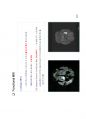 방사선사 MRI 국가고시 2차 정리집 두번째 입니다. - MRI 70페이지