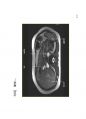 방사선사 MRI 국가고시 2차 정리집 두번째 입니다. - MRI 73페이지