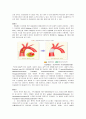 대동맥 박리(aortic dissection) 문헌고찰 (병태생리, 원인, 증상, 진단검사, 치료, 간호, 합병증, 예방방법) 3페이지