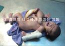 의학 - 기형이 생기는 이유 8페이지