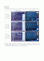 [실험보고서] 함수발생기(function generator) 및 오실로스코프(oscilloscope) 사용법 : 함수발생기의 사용법과 파형에 대한 기본적인 용어를 익힌다 & 오실로스코프의 사용법을 익힌다 7페이지