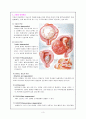 [여성간호학실습] 자궁근종 Laparoscopic myomectomy 근종절제술 케이스 스터디(CaseStudy) 3페이지