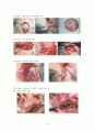 [여성간호실습] 제왕절개(C / Sec : cesarean section) 케이스 스터디(CaseStudy) 4페이지