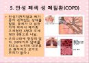 노화와 관련된 호흡기계변화(천식, COPD, 만성기관지염, 폐기종, 폐렴, 질환에 따른 간호) 19페이지