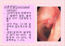 노화와 관련된 호흡기계변화(천식, COPD, 만성기관지염, 폐기종, 폐렴, 질환에 따른 간호) 35페이지