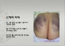 아동학대.PPT 5페이지