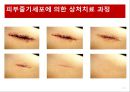 [생명공학] 줄기세포치료제에 관해서.pptx 5페이지