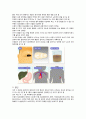 신생아 담도폐색증 Biliary Atresia 4페이지