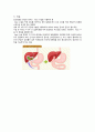 신생아 담도폐색증 Biliary Atresia 5페이지