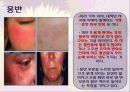 「화장품 부작용」 관련 자료 (화장품 부작용이란?, 화장품 부작용 종류, 부작용을 일으키는 성분들, 부작용 예방법과 해결책).pptx 10페이지