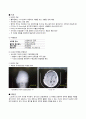 [성인간호학실습] subdural Hemorrhage SDH 경막하 출혈 Case study 케이스 스터디 5페이지