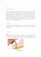 [간호학] 담낭염 케이스 스터디 choecystitis case study (연구의 필요성 및 목적과 연구방법, 문헌고찰, 자료 및 연구 방법, 자료수집, 간호과정) 2페이지
