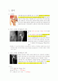 고관절 반치환술 (Bipolar Hemiarthroplasty) & 전치환술 (THR)

 3페이지