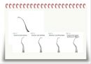 비외과적 & 외과적 치주치료 {Scaling, Root planing, 치주수술의 개요 및 일반원칙, 치은연하 소파술, 치은절제술과 치은성형술}.pptx
 8페이지