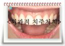 비외과적 & 외과적 치주치료 {Scaling, Root planing, 치주수술의 개요 및 일반원칙, 치은연하 소파술, 치은절제술과 치은성형술}.pptx
 12페이지