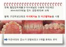 비외과적 & 외과적 치주치료 {Scaling, Root planing, 치주수술의 개요 및 일반원칙, 치은연하 소파술, 치은절제술과 치은성형술}.pptx
 40페이지