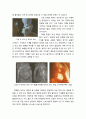 [영유아발달] ≪태내발달(胎內發達/prenatal development)≫ 수정, 태내발달의 단계(난체기,배아기,태아기), 태아의 뇌 발달 : 뉴런의 이동 6페이지