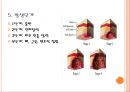 욕창간호 {정의, 발생원인, 위험요인, 발생부위, 발생단계, 치료, 간호와 예방}.pptx 21페이지