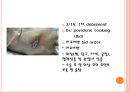 욕창간호 {정의, 발생원인, 위험요인, 발생부위, 발생단계, 치료, 간호와 예방}.pptx 37페이지