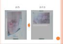 욕창간호 {정의, 발생원인, 위험요인, 발생부위, 발생단계, 치료, 간호와 예방}.pptx 42페이지