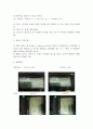 [환경실험보고서] 부영양화(富營養化) 실험 : 하천과 호수에서 인 및 질소가 부영양화에 미치는 영향을 이해하고, 부영양화를 막을 수 있는 방법을 생각해 본다 2페이지