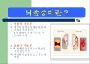 지질과 뇌졸중 - 지방에 대함과 뇌졸증과의 연관성,정의.ppt 8페이지
