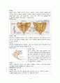정형외과 골반질환손상 골반구조 간호과정 케이스 스터디 Case Study - 진단명: acetabulum Fx(비구골절) 주호소: Rt leg tingling sense, Rt leg pain 4페이지